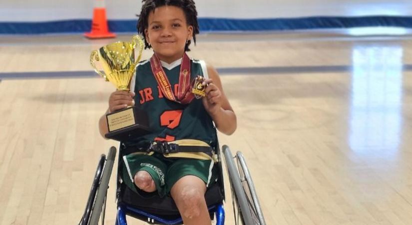 Borzasztó: mindkét lábát amputálni kellett a kisfiúnak egy közönséges influenza miatt