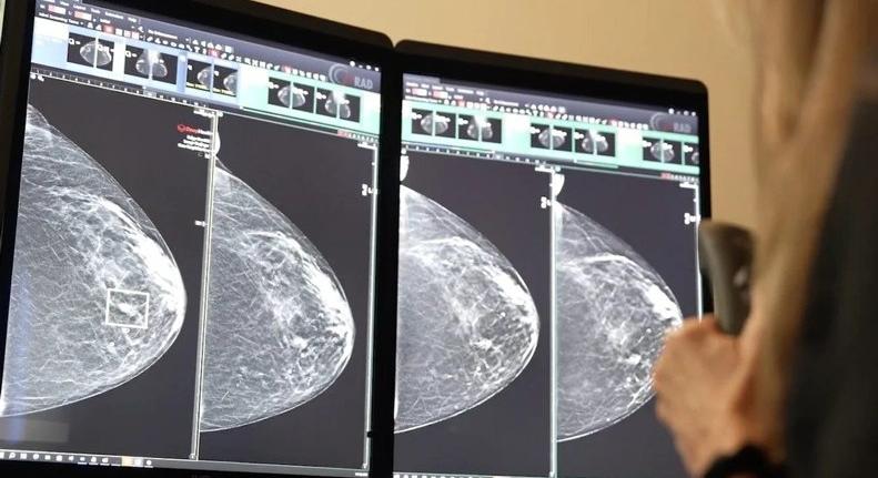Áttörés a mellrákszűrésben? A DeepHealth új platformja már most átírja a radiológia jövőjét