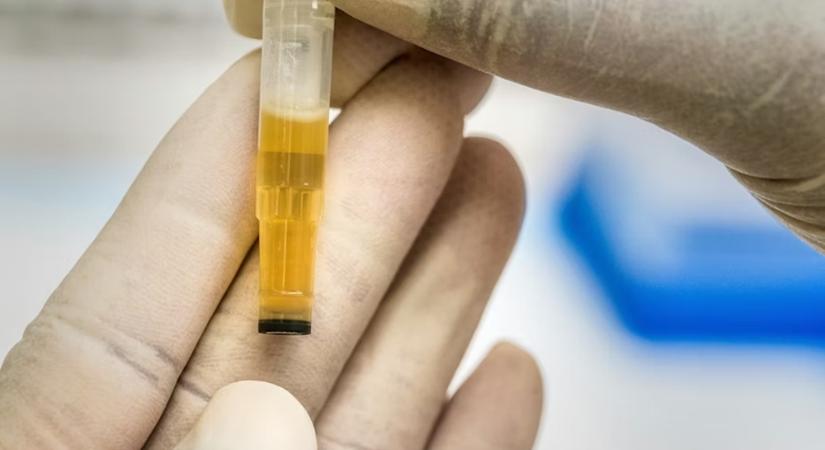 Meglepő jel a fürdőszobából: jelezheti-e a vizeletünk a demencia kockázatát?