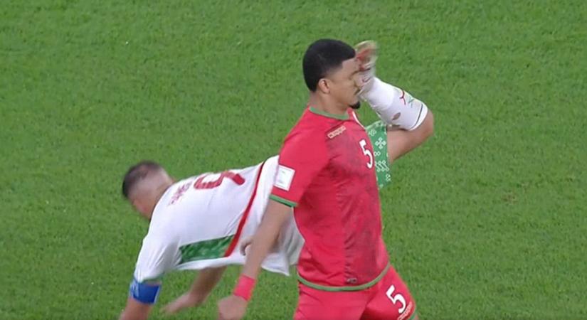 Bravúros megoldásnak szánta, véresre rúgta az ellenfele fejét