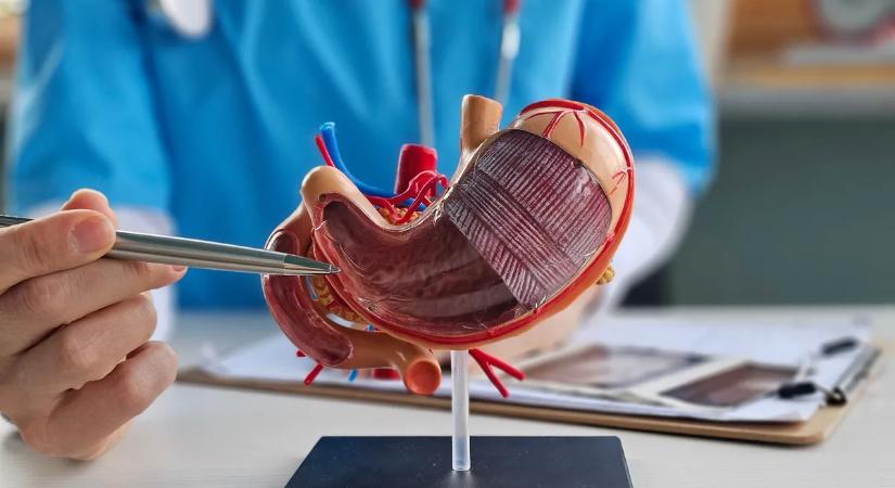 Amikor a gyomor jelzi, hogy baj van: így ismerd fel a gyomorfekélyt