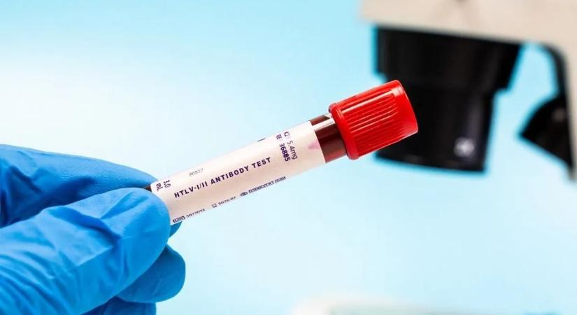 Hihetetlen! Rákellenes gyógyszer lehet az öregedés ellenszere?