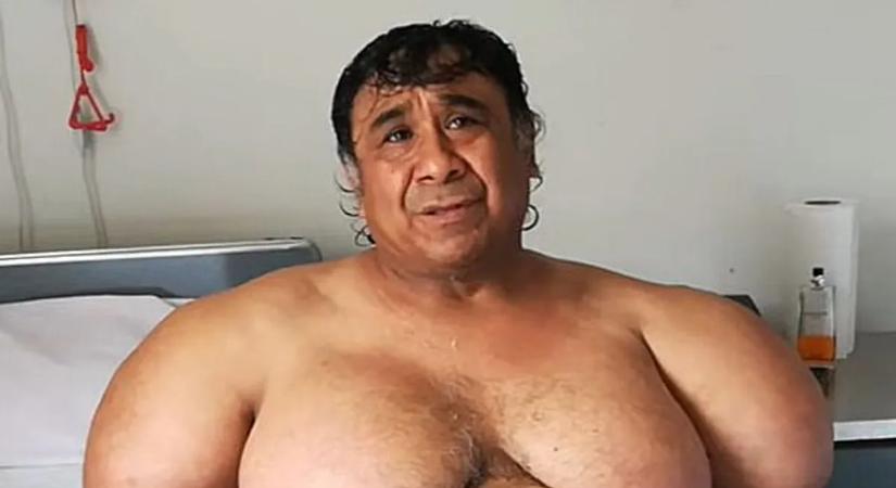 Az orvosok tanácstalanok: Popeye-ként él a perui búvár