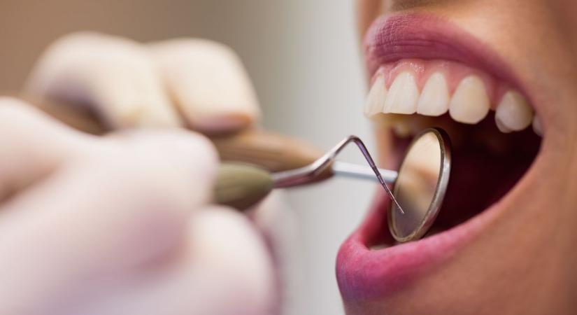 Mozgó fogak megmentése: létezik megoldás – mutatjuk, mire figyeljen