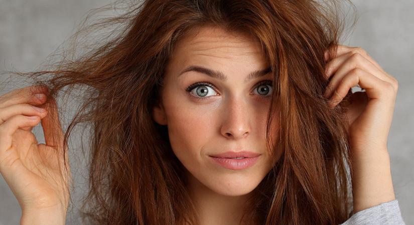 Vékonyodik a hajad? Ezzel a hibával éveket öregítesz magadon