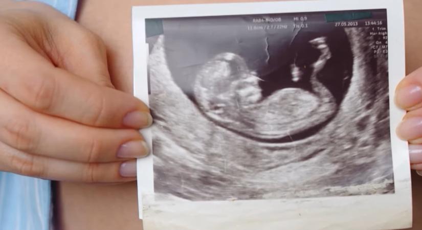 Virágzik a nemszelekciós lombikprogramok üzletága Észak-Cipruson