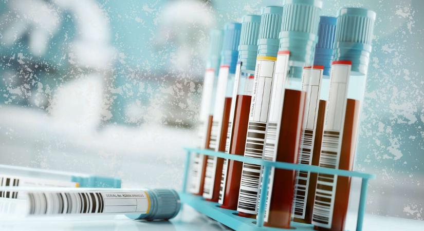 Életmentő vizsgálat TB-támogatását kérik az anafilaxiások