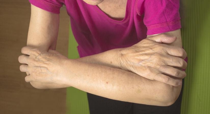 Durva, mi nőtt az 58 éves nő karjára: először legyintett a tünetre, majd megállt benne az ütő, amikor értesült a diagnózisról