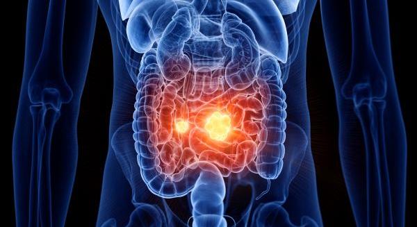 Új játékosok a régi játszótéren: IBD update