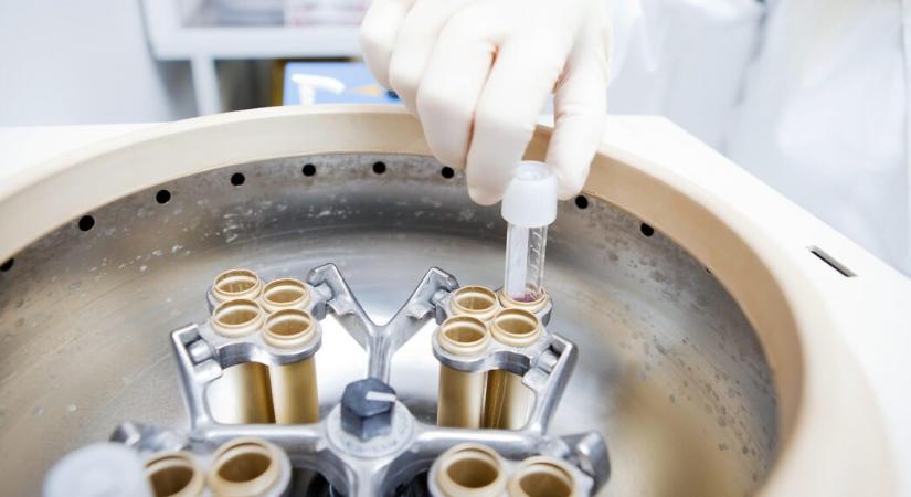 Ritka genetikai rendellenességet hordozott egy dán spermadonor