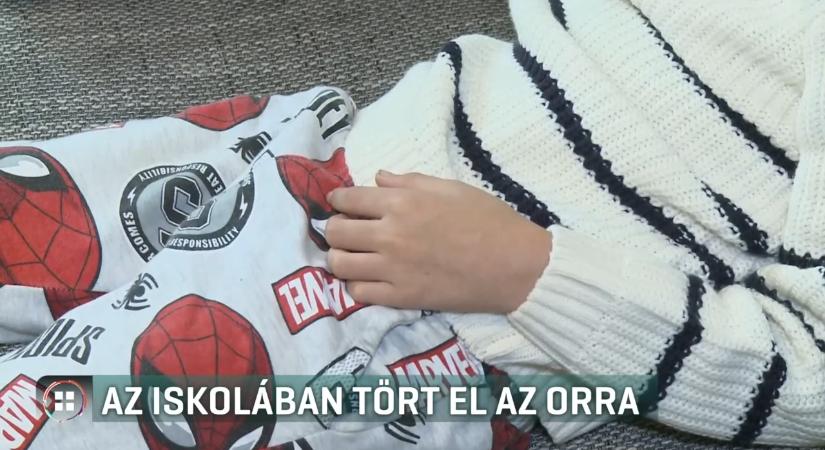 Orrtörést szenvedett egy 11 éves tatabányai fiú – apja szerint az iskola nem védi meg a gyerekét