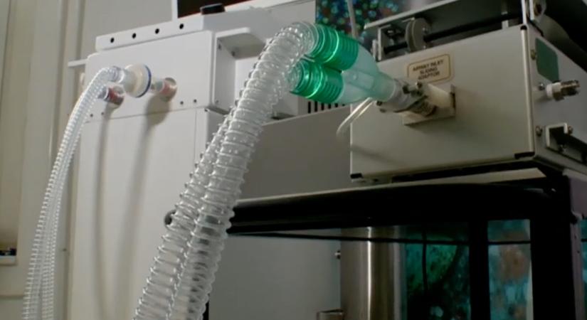 Egy magyar cég a NASA-t is megelőzve készített lélegeztetőgépet