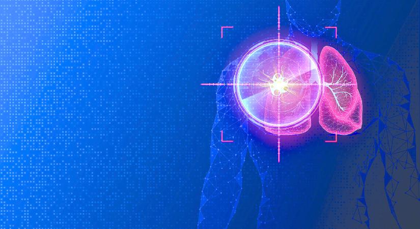 A metasztatikus nem kissejtes tüdőrák immunterápiája