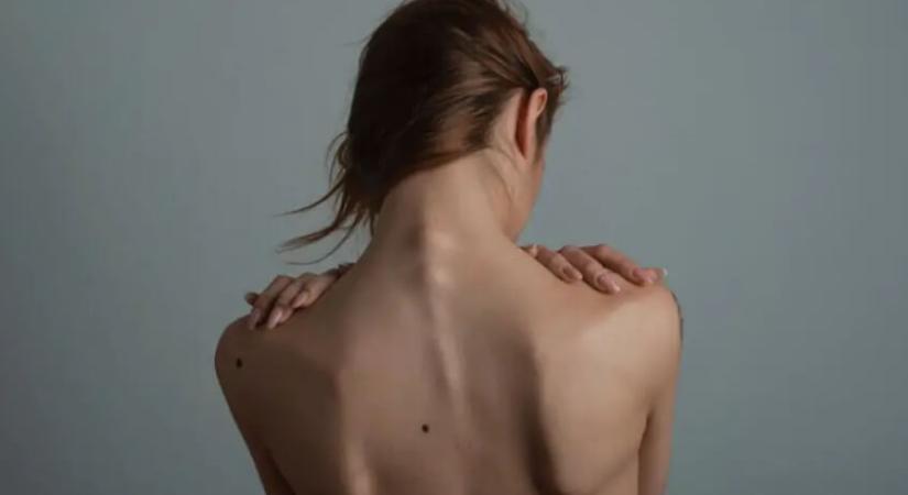 A mozdulatlanság művészete: hogyan gyógyít a pihenés?