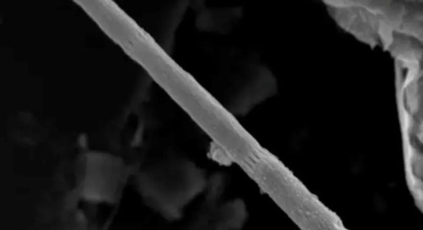 Elektromos áramot vezető baktériumok forradalmasíthatják az egészségügyet