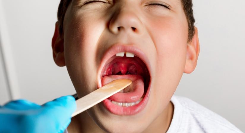 A Tisza-csomag a gyermekektől is elvenné az ingyenes egészségügyi ellátást