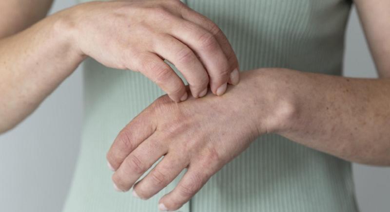 Kolozsvár: A második leprás megbetegedést is megerősítették