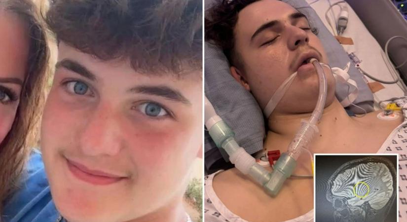 „Orvosi hiba?!” – Egy 14 éves fiú hónapokig panaszkodott fejfájásra, majd összeesett: ekkor derült ki a döbbenetes igazság