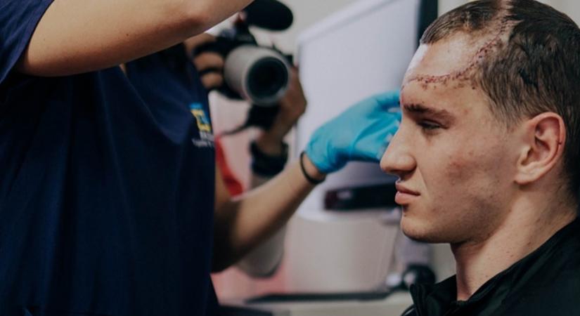 Új arcot adnak az ukrán katonáknak