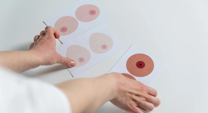 Mellbimbótöltés és intimplasztika: a legextrémebb esztétikai beavatkozások, amelyekre egyre többen vállalkoznak