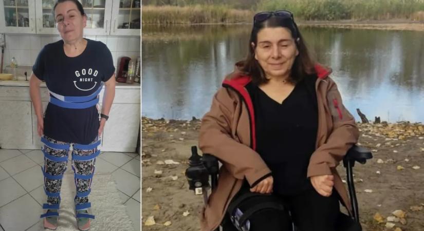 Görcsök kínozzák, megvakult, a gerincét csavarok tartják – Mónika gyógyíthatatlan betegséggel küzd