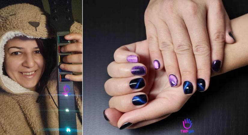 Renáta különös ajándékot kapott a sorstól - ő az egyetlen, 12 ujjal született zongorista a világon