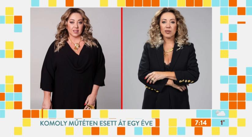 Tóth Ildikó 45 kilót fogyott: őszintén vallott műtétjéről