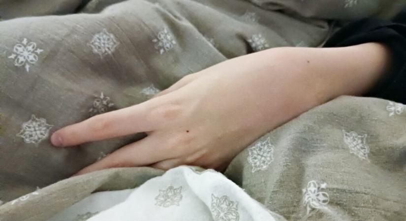 Tizenhárom éve várnak a státuszuk rendezésére a beteg gyermeküket 24 órában gondozó szülők