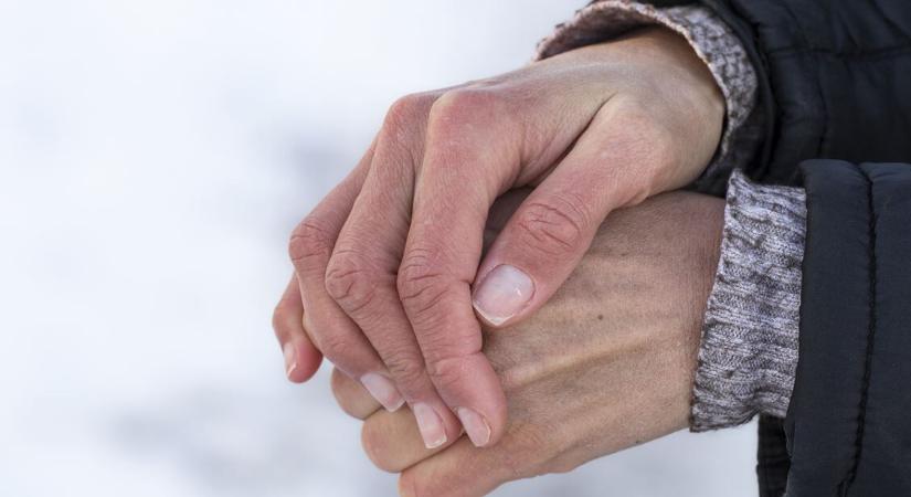 Telente szárazabb a bőröd? Betegség is állhat mögötte