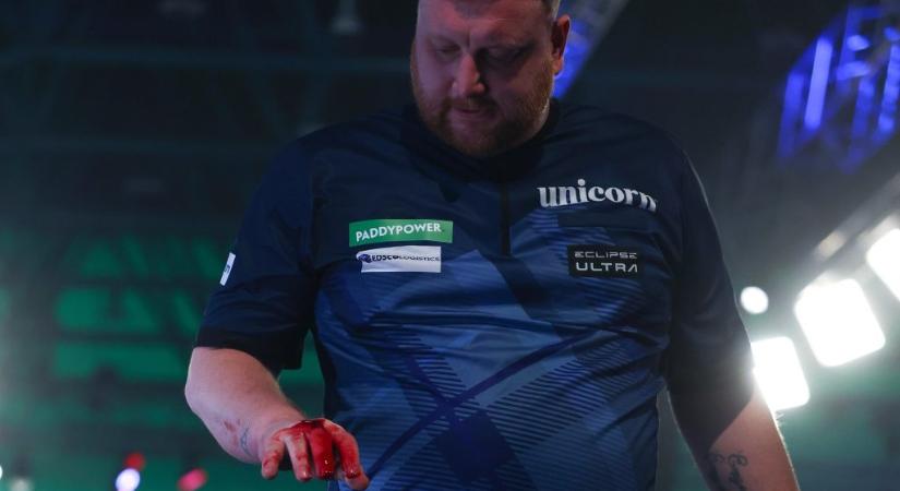 Folyt a vér a dartsvébén: dühében az asztalt verte a kieső játékos