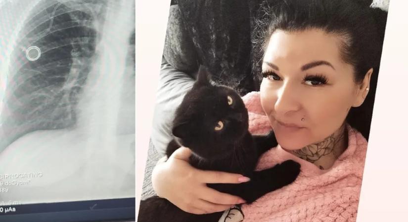 „Nagyon aggódom érted!” – életveszélyes állapotban került intenzív osztályra a mellrákkal küzdő Julianna