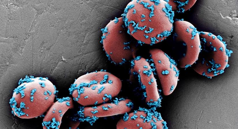 A rákgyógyítás csodafegyvere lehet ez az új kezelés, már bizonyított