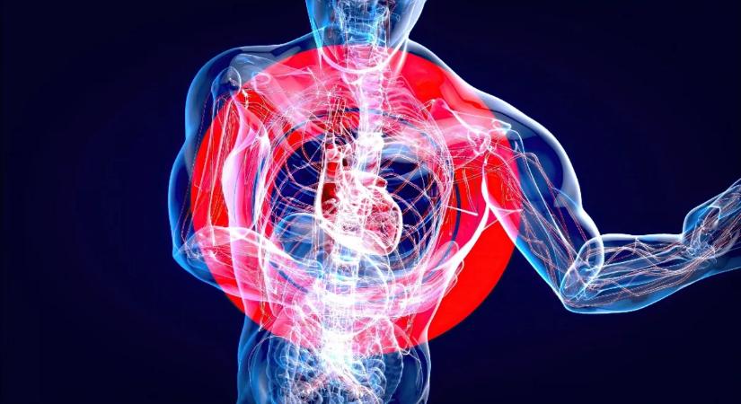 A szívroham, amit nem látsz jönni – az orvosok is meglepődtek