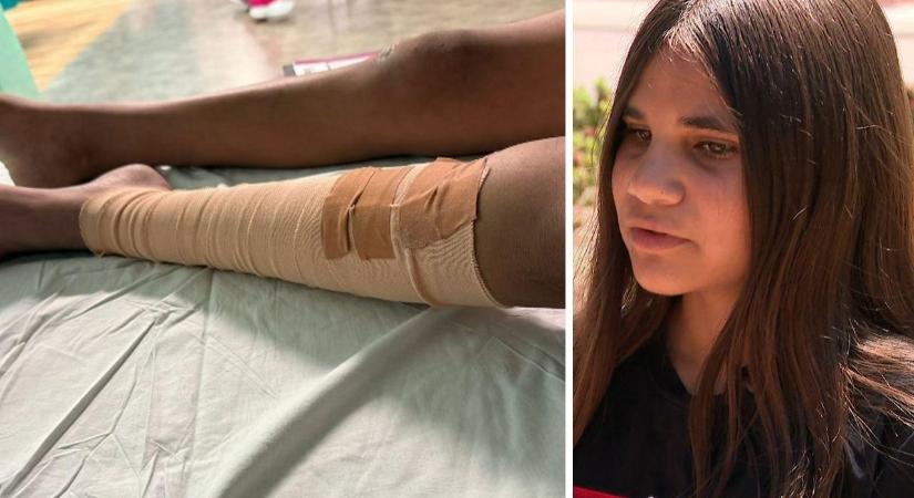 Ausztráliában egy kislány túlélte a tigriskígyó – a világ egyik legmérgezőbb hüllője harapását