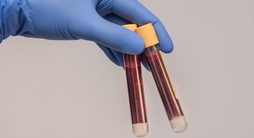 A vérplazmaadás jelentősége és feltételei