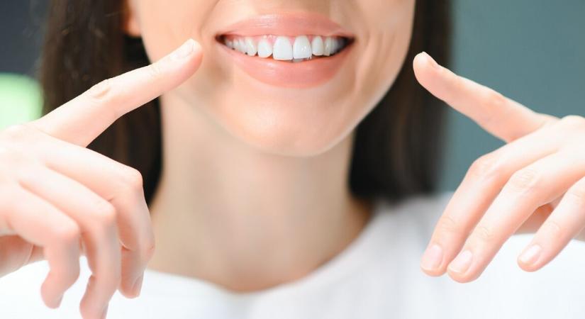 Természetes fogfehérítés olcsón – csak két zöldség kell hozzá