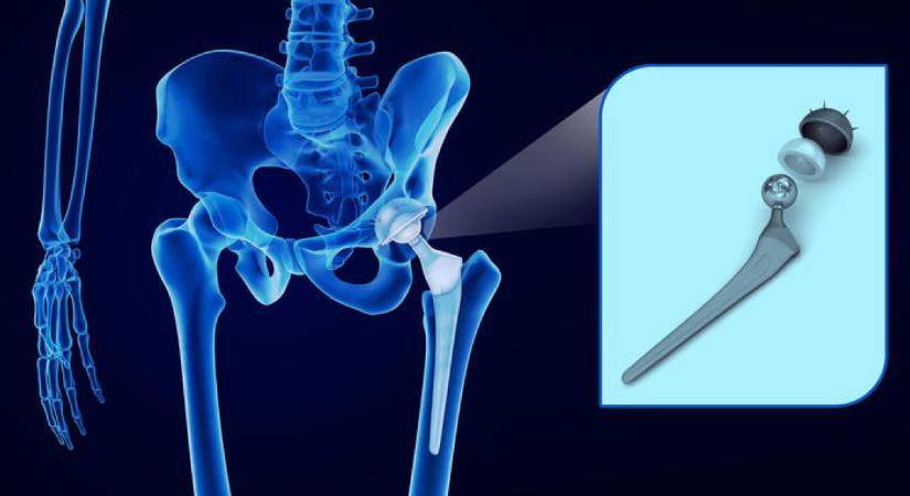 Közel 38 ezren várakoznak 2025 végén műtétre