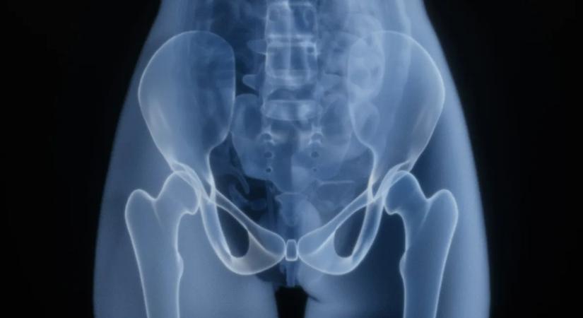 Csípőfájdalom? Ezekkel a tünetekkel azonnal forduljon orvoshoz!