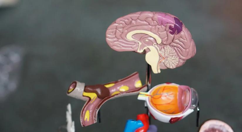 Szenzációs felfedezés: áttörés jöhet az egyik legagresszívabb daganat kezelésében