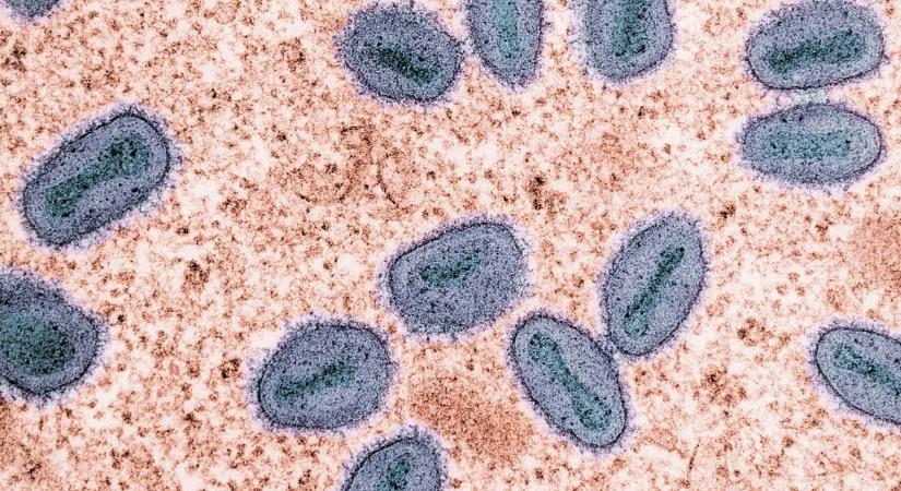 Mutatjuk, mi történne, ha a madárinfluenza emberről emberre terjedne