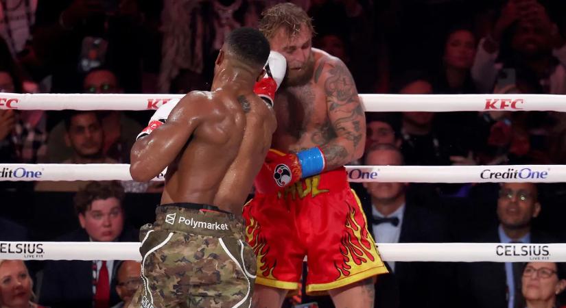 Titánlapokkal kellett összeeszkábálni Jake Paul összetört állkapcsát – kép