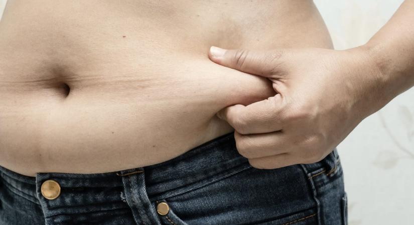 Elhízást okoz egy génmutáció, viszont csökkenti a szívbetegségek kockázatát