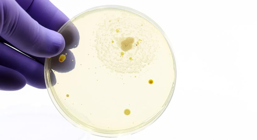 Borzasztó lista: egyre több a veszélyes élelmiszer Magyarországon