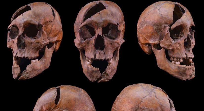 Egy középkori gyilkosság története – kutatók azonosítottak egy Árpád-házi herceget, és szenzációs megállapításokat tettek