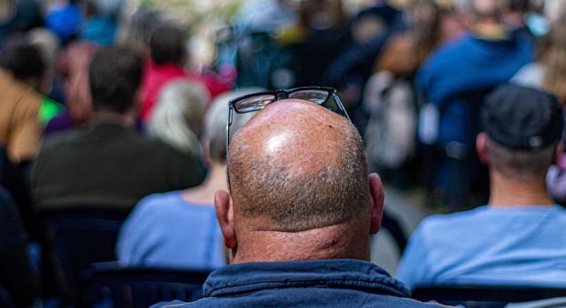 Az elnök, aki támogatni szeretné a hajhullás kezelésének finanszírozását: „a túlélés kérdése”