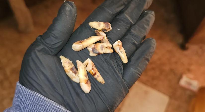 Hátborzongató: emberi fogakat rejtett a skizofrén férfi lakása