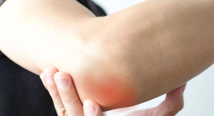 A sötét és érdes könyökért nem a kosz a felelős – Ez állhat a háttérben