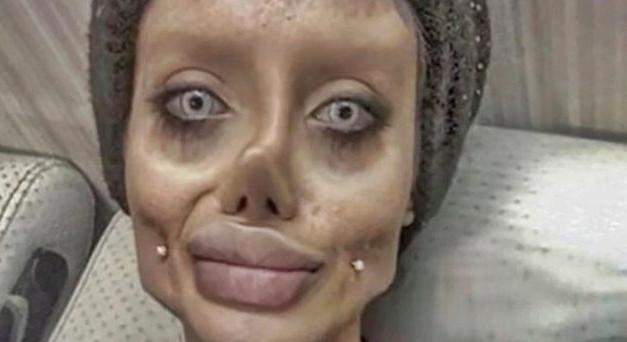 Döbbenet! Angelina Jolie szeretett volna lenni, élő zombivá vált a sok plasztikától