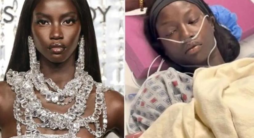 Lesújtó diagnózist kapott a gyönyörű modell, azonnal műteni kellett