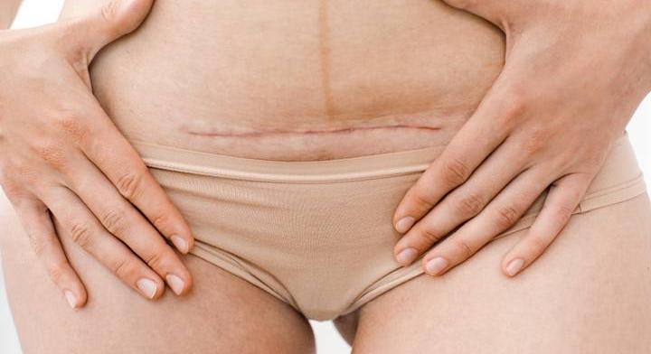 Középiskolások nézték végig a császármetszést – videón a reakciók!